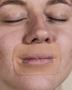 Myotape