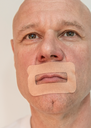 Myotape sensitive